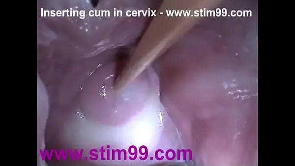 Hot Insertion Semen Cum in Cervix Wide Stretching Pussy Speculum clips Clips